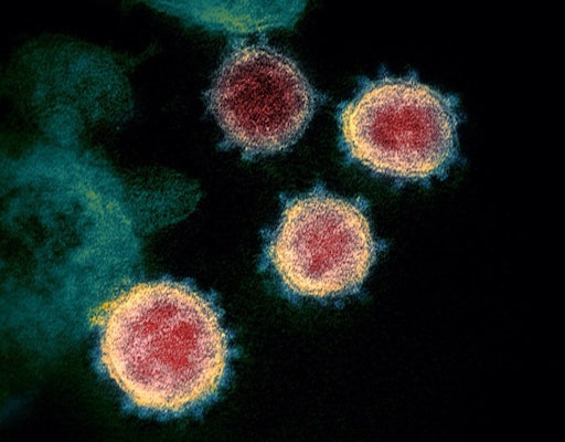 | Closeup of coronavirus through microscope Image courtesy of Peoples History of the Coronavirus PandemicNational Institutes of Health Rocky Mountain Laboratories | MR Online